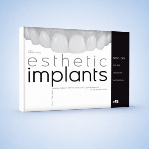 Esthetic Implants - Edra Publishing book cover