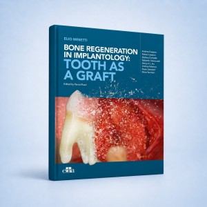 Bone regeneration in implantology: tooth as a graft - Edra Publishing book cover